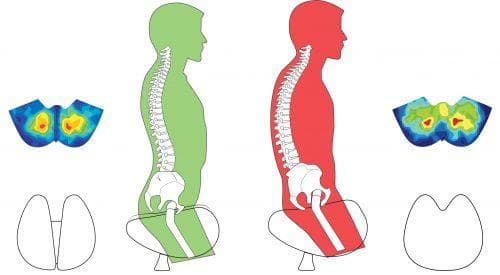 Illustration comparing spine position when sitting on a one-part chair versus a two-part Salli saddle chair